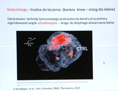 JUBILEUSZ 20-lecia UTW  w Andrychowie | 86